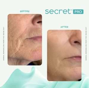 1771254265_IMG_3032-e1721911371623-300x298-1