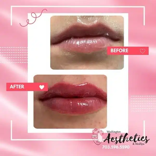 440342429_18311902837148567_8093289384624836419_n-600x600