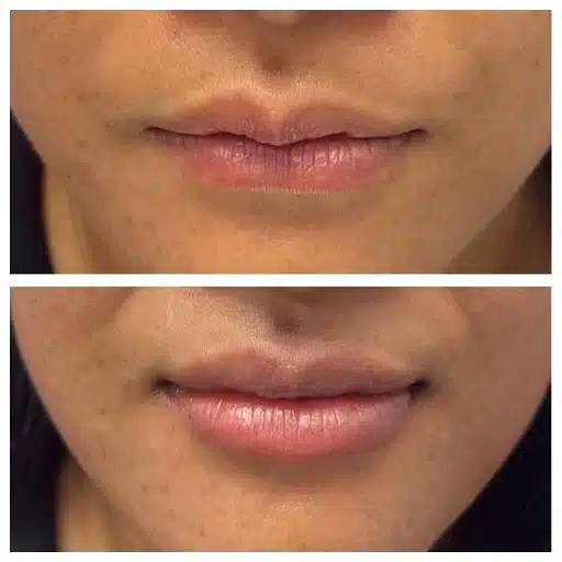 455266263_18324171160148567_5212049632266157847_n