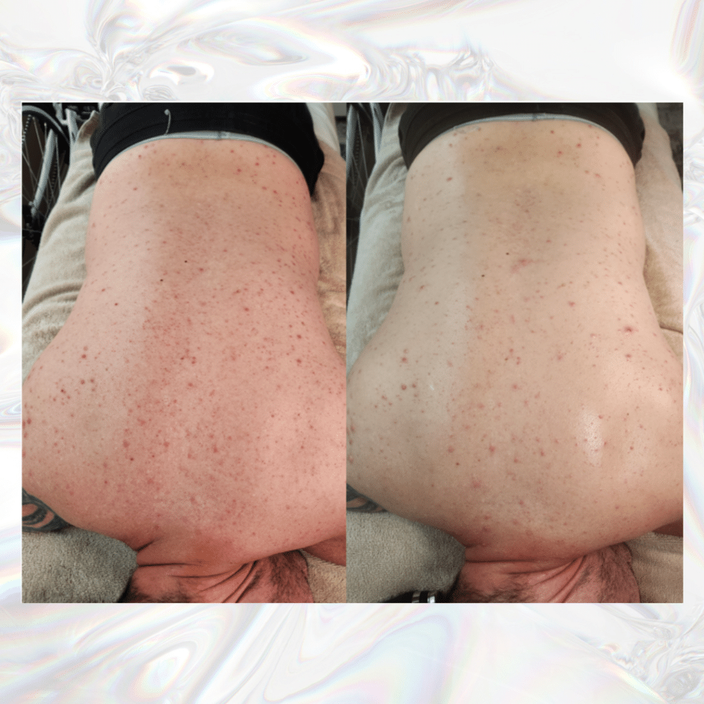 Body-Bubbles-Back-Before-and-After