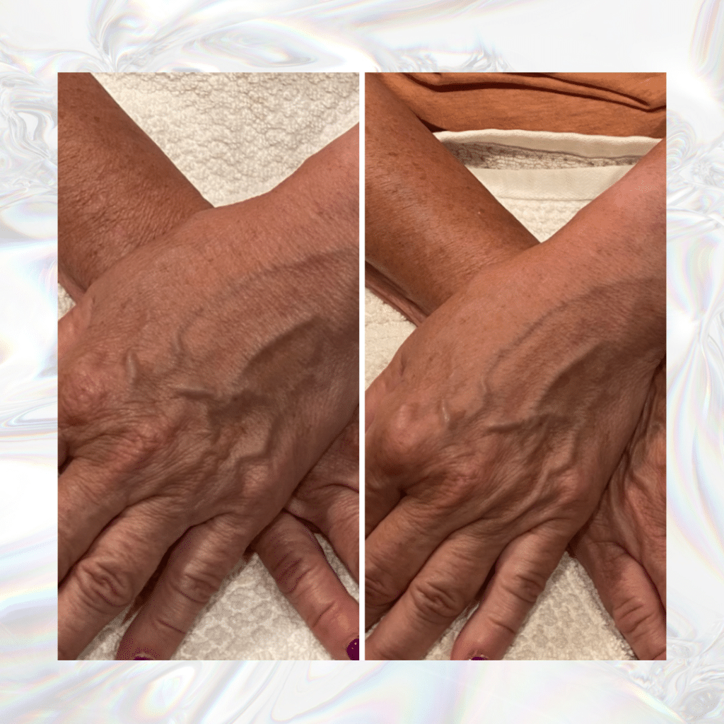 Body-Bubbles-Hand-Before-and-After