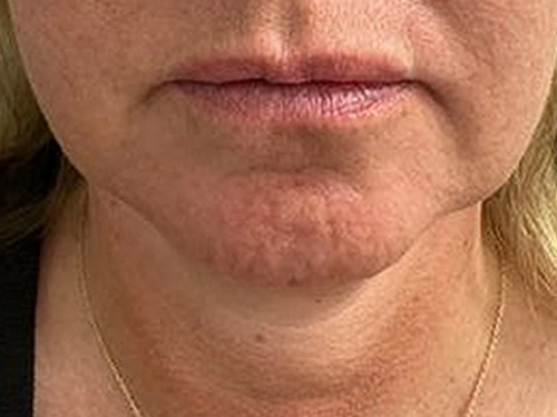 After Image: Neurotoxin - front